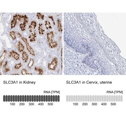 SLC3A1 Antibody, Novus Biologicals 0.1mL; Unlabeled:Antibodies, Polyclonal